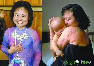 儿童节谈越南战争最著名女童：最后去了美国